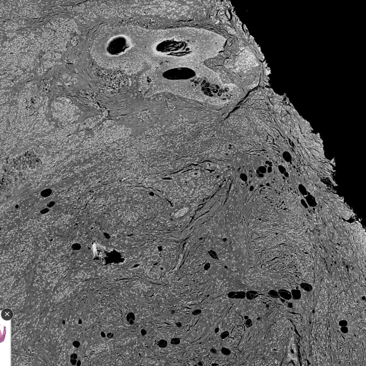 BW + INV
